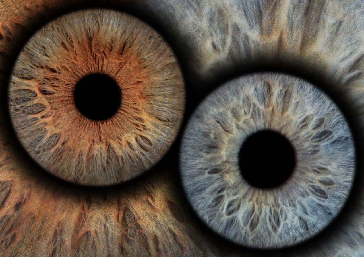 Youreyes: фотография из карточки